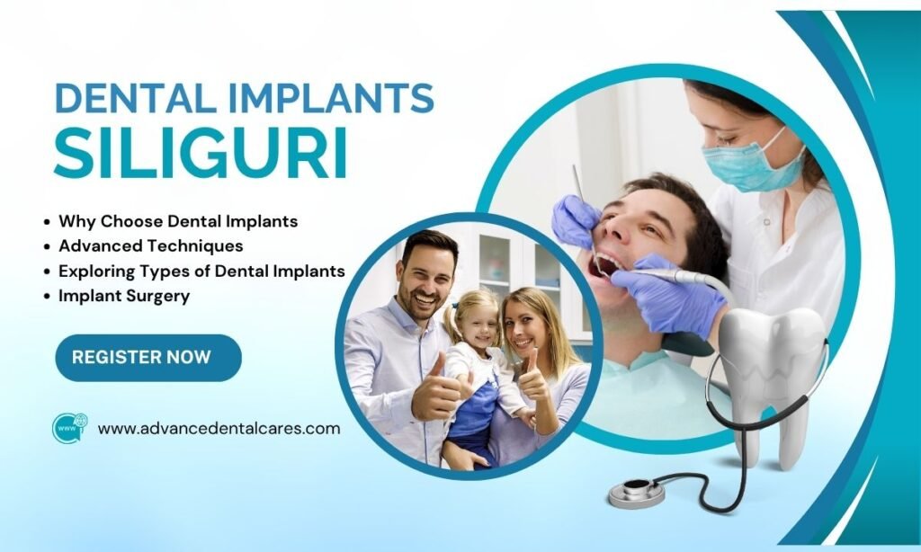 Best Dental Implants in Siliguri