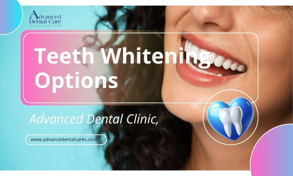 Best Teeth Whitening Options